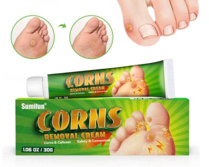 Corns  Sumifun Крем за премахване на мазоли, крем за кожни инфекции от мазоли, мехлем за лечение на мазоли и кокоши трън, инструмент за премахване на мъртва кожа, здравни грижи 1 брой