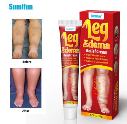 Sumifun Leg Edema relief cream Крем за облекчаване на отоци на крака  - 20 г