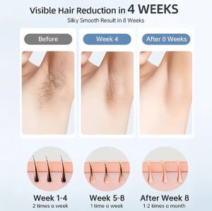 FEIYBA 3-в-1 безжичен тример, подходящ за жени - за лице, тяло и бикини зона