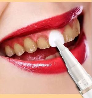 Писалка за избелване на зъби Oralhoe , гел за избелване на зъби, избелващ гел, премахва петна, хигиена на устната кухина
