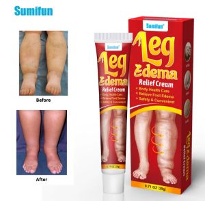Sumifun Leg Edema relief cream Крем за облекчаване на отоци на крака  - 20 г