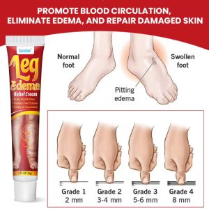 Sumifun Leg Edema relief cream Крем за облекчаване на отоци на крака  - 20 г