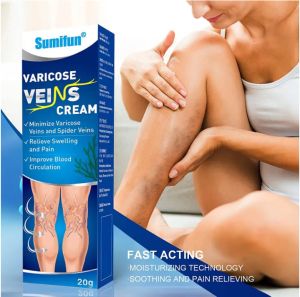 Sumifun Varicose Veins Cream мехлем за разширени вени  външна грижа за кожата 20 грама
