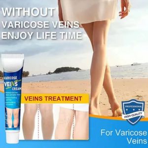 Sumifun Varicose Veins Cream мехлем за разширени вени  външна грижа за кожата 20 грама