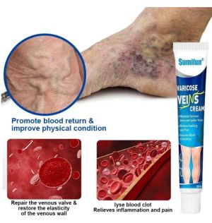 Sumifun Varicose Veins Cream мехлем за разширени вени  външна грижа за кожата 20 грама