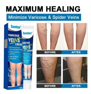 Sumifun Varicose Veins Cream мехлем за разширени вени  външна грижа за кожата 20 грама